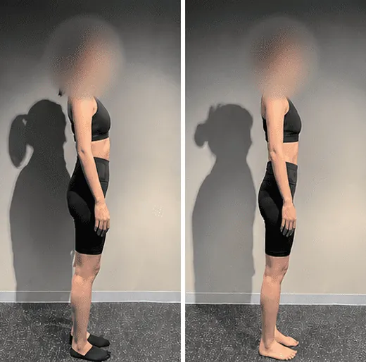 30代女性、2ヶ月で6.3kg減のビフォーアフター(横から)